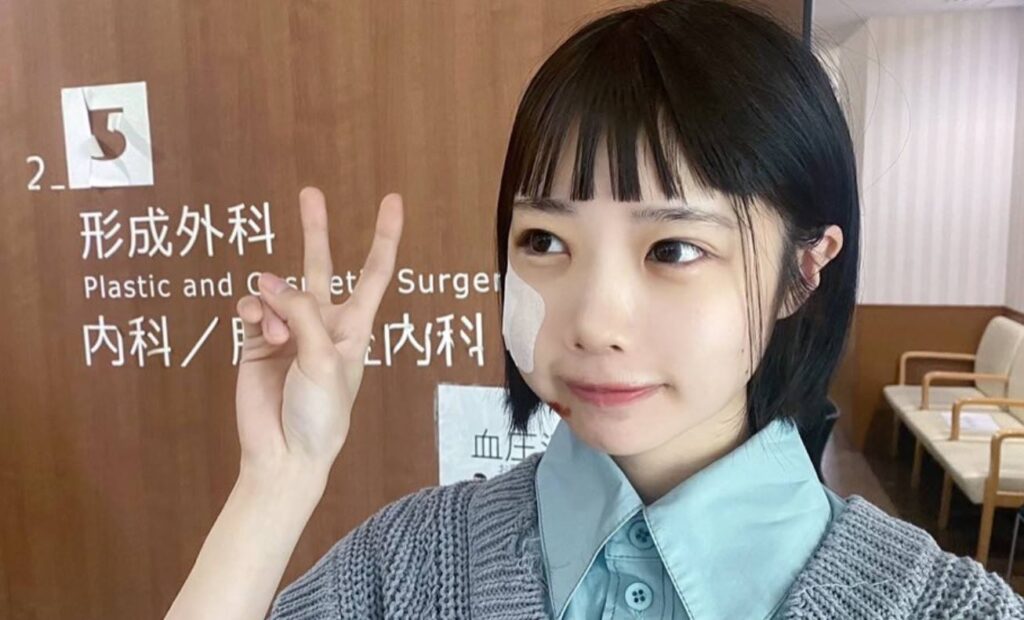あのちゃん